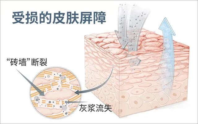 拒绝烂脸，修复皮肤屏障